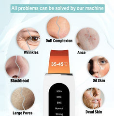 Ultrasonic Blackhead Remover with Microcurrent & LED Light