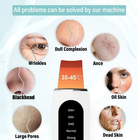 Ultrasonic Blackhead Remover with Microcurrent & LED Light